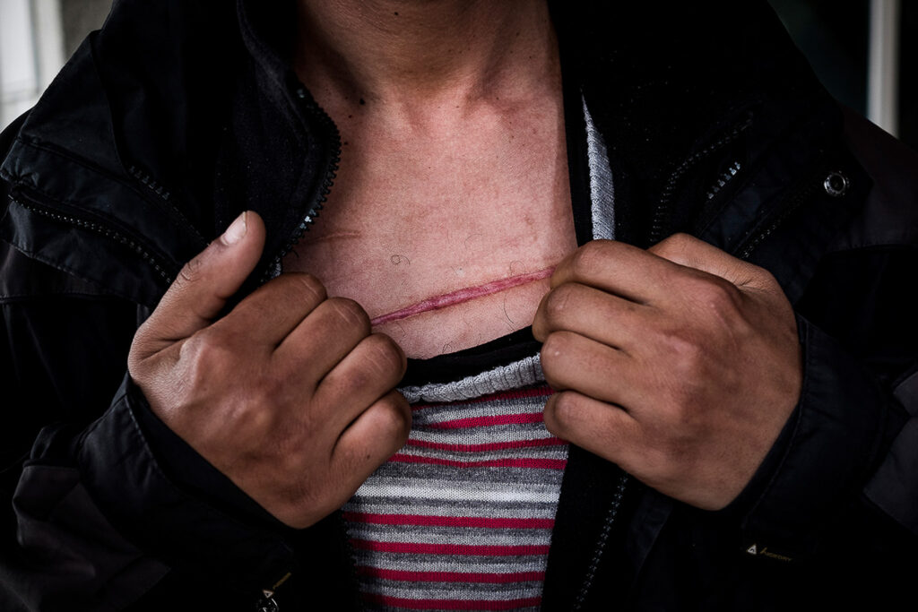 Along the Balkan route, many migrants report being beaten and robbed by Croatian police, and pushed back without the possibility of requesting asylum. In 2019, President Kolinda Grabar-Kitarović both acknowledged and denied the use of force in the defence of Europe’s borders. Velika Kladuša, Bosnia and Herzegovina, 2019.